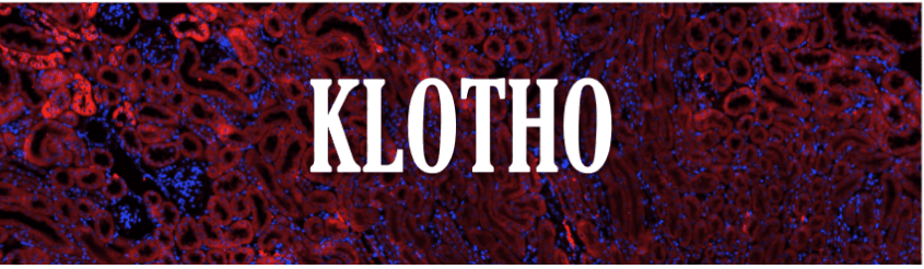 A close up of the word " klotho ".