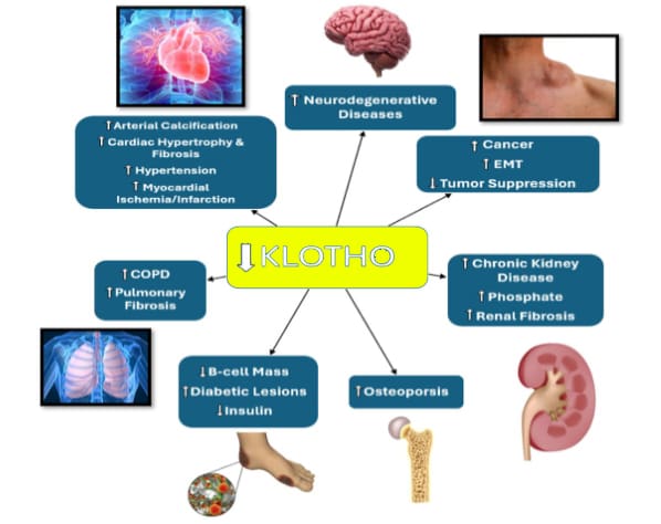Diagram showing decreased Klotho linked to diseases